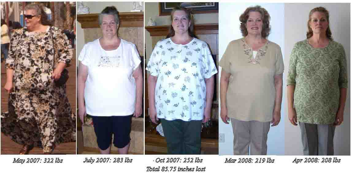before and after hcg diet. Hcg Diet