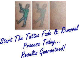 Nuviderm.com Releases Their Revolutionary Tattoo Removal ...
