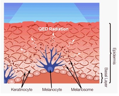 QED induced UV from melanin NPs causing DNA damage leading to basal carcinoma