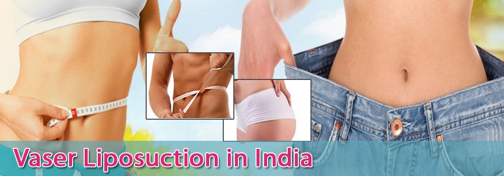 low-cost-vaser-liposuction-in-india